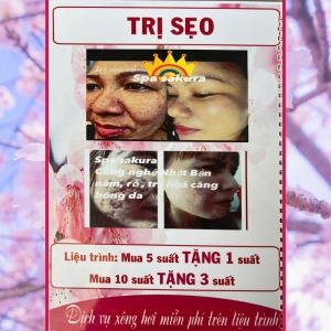 TRỊ SẸO